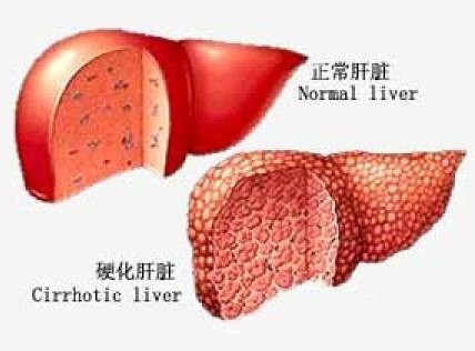 龍魚(yú)腹水抽水后多久會(huì)恢復(fù)？【龍魚(yú)腹水抽水后的恢復(fù)時(shí)間】