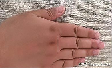 龍眼爛尾病藥劑哪個品牌最好，龍眼全生育期病害防治用藥方案
