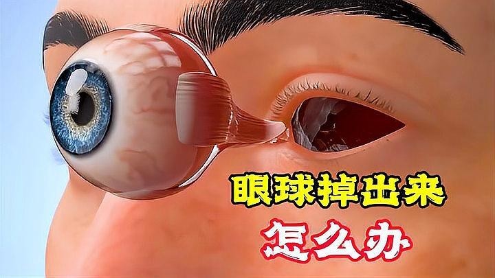 龍魚眼睛為什么要做手術（龍魚眼睛為什么要做手術智能模式回答完成調用工具）