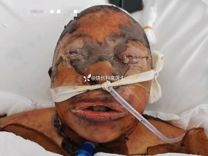 銀龍魚嘴巴撞壞了多久能好啊圖片 銀龍魚嘴巴撞壞了多久能好啊圖片 龍魚百科 第19張