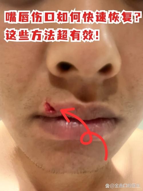 銀龍魚嘴巴撞壞了多久能好啊圖片 銀龍魚嘴巴撞壞了多久能好啊圖片 龍魚百科 第7張