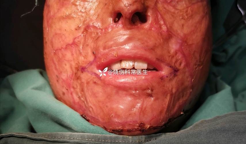 銀龍魚嘴巴撞壞了多久能好啊圖片 銀龍魚嘴巴撞壞了多久能好啊圖片 龍魚百科 第14張