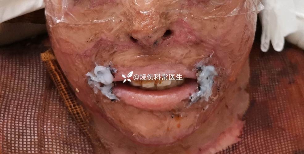 銀龍魚嘴巴撞壞了多久能好啊圖片 銀龍魚嘴巴撞壞了多久能好啊圖片 龍魚百科 第12張