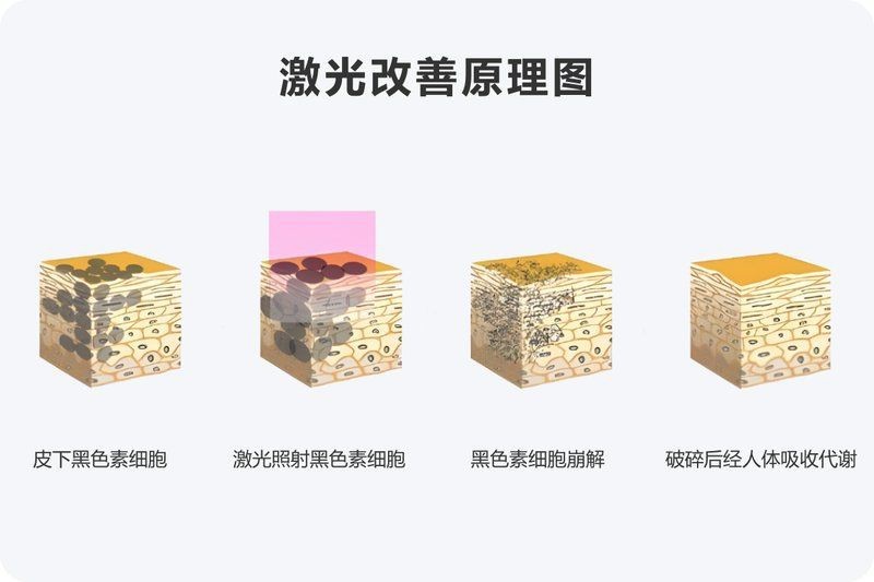 蝴蝶唇都是又大又黑嗎
