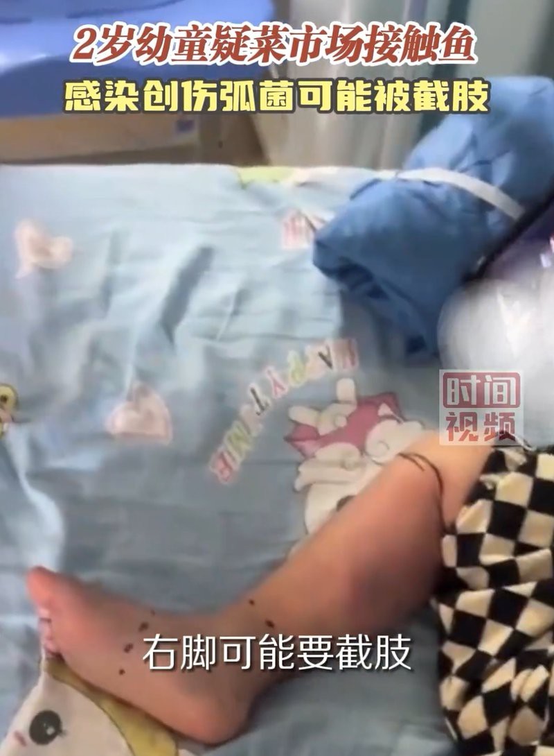 長(zhǎng)期接觸龍魚(yú)有哪些潛在風(fēng)險(xiǎn)？