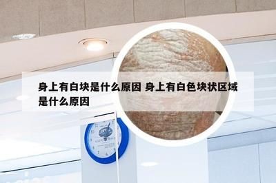 魚缸白色塊狀是什么：魚缸中的白色塊狀物可能是由幾種不同原因導致的