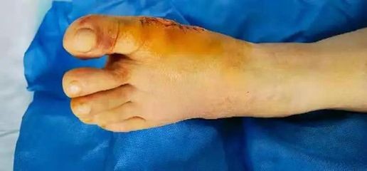 龍魚腮部鼓包怎么治（龍魚腮部鼓包怎么治龍魚腮部疾病需要及時(shí)治療） 龍魚腮部鼓包怎么治（龍魚腮部鼓包怎么治龍魚腮部疾病需要及時(shí)治療） 龍魚百科 第3張