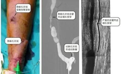龍魚腮部鼓包怎么治（龍魚腮部鼓包怎么治龍魚腮部疾病需要及時(shí)治療） 龍魚腮部鼓包怎么治（龍魚腮部鼓包怎么治龍魚腮部疾病需要及時(shí)治療） 龍魚百科 第5張