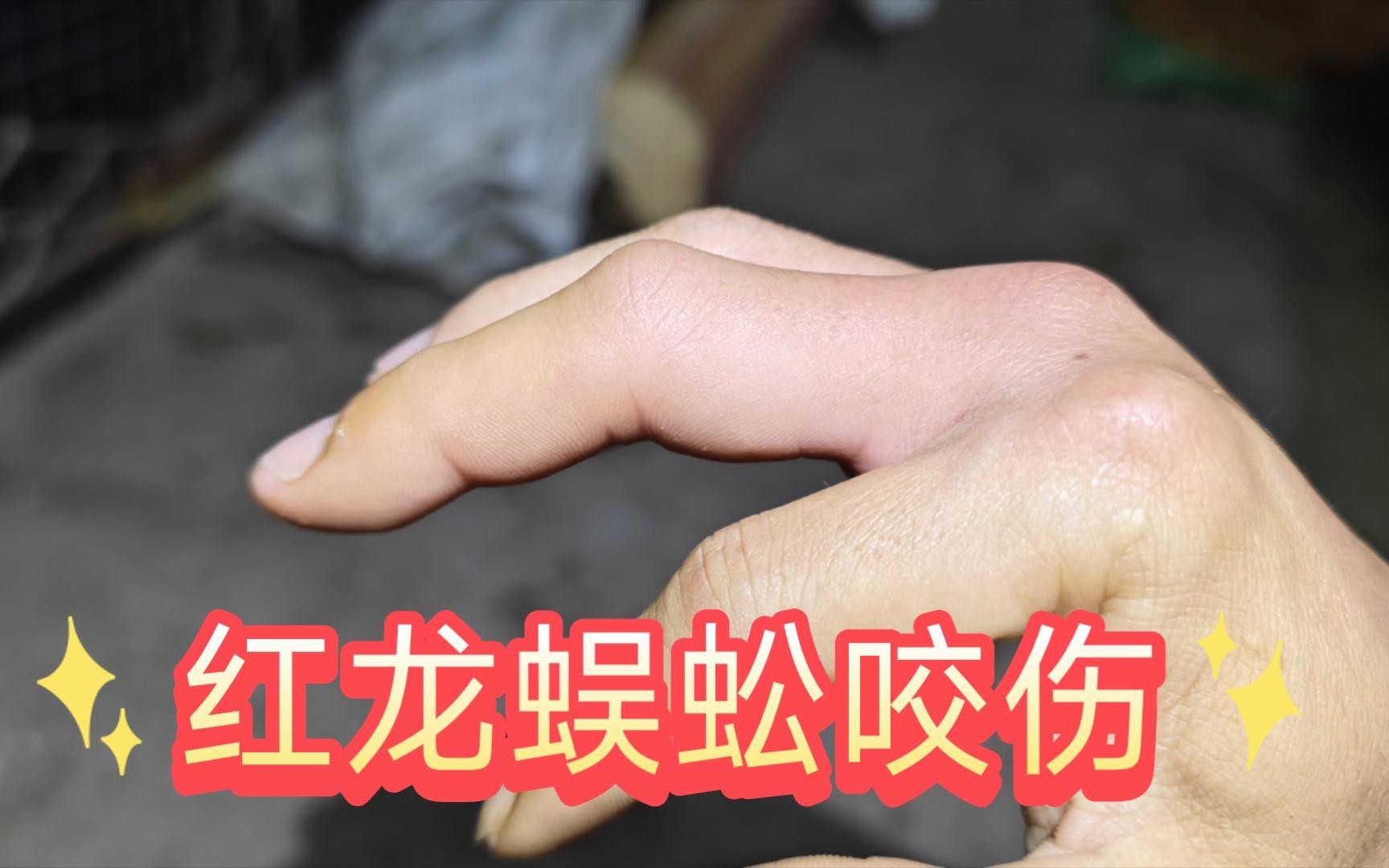 紅龍蜈蚣與黑龍蜈蚣的戰(zhàn)斗結(jié)果如何？