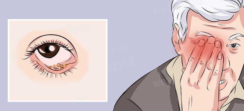 眼皮內(nèi)側(cè)小白點(diǎn)可以擠破嗎？