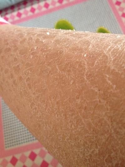 銀龍魚鱗片上有斑點正常嗎圖片