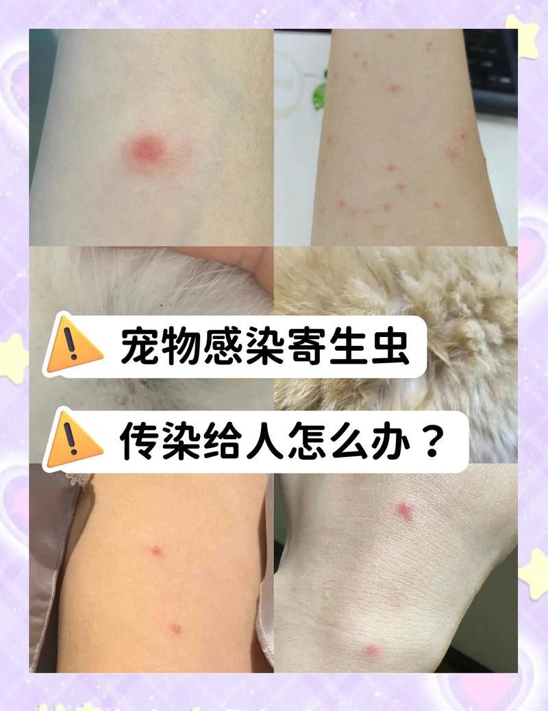 龍魚(yú)感染體外寄生蟲(chóng)會(huì)傳染給人嗎？