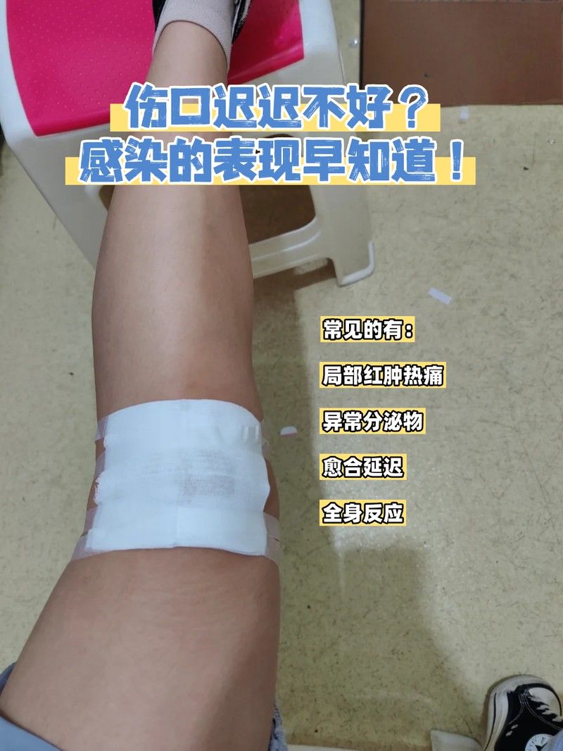 如何判斷過背金龍珠鱗損傷是否感染？