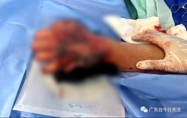 龍魚傷口感染多久會死？