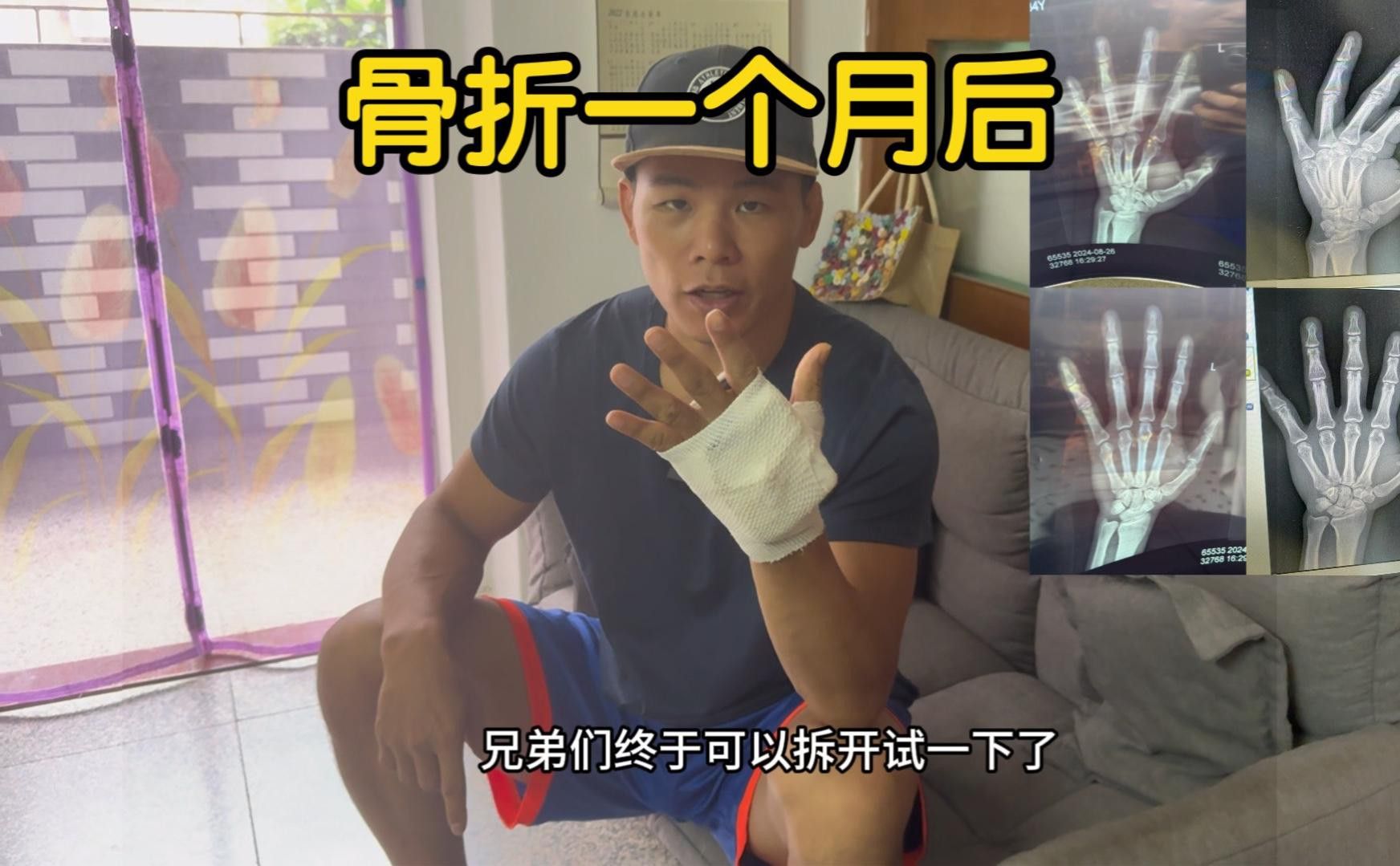 夾板治療期間需要多久換一次水？