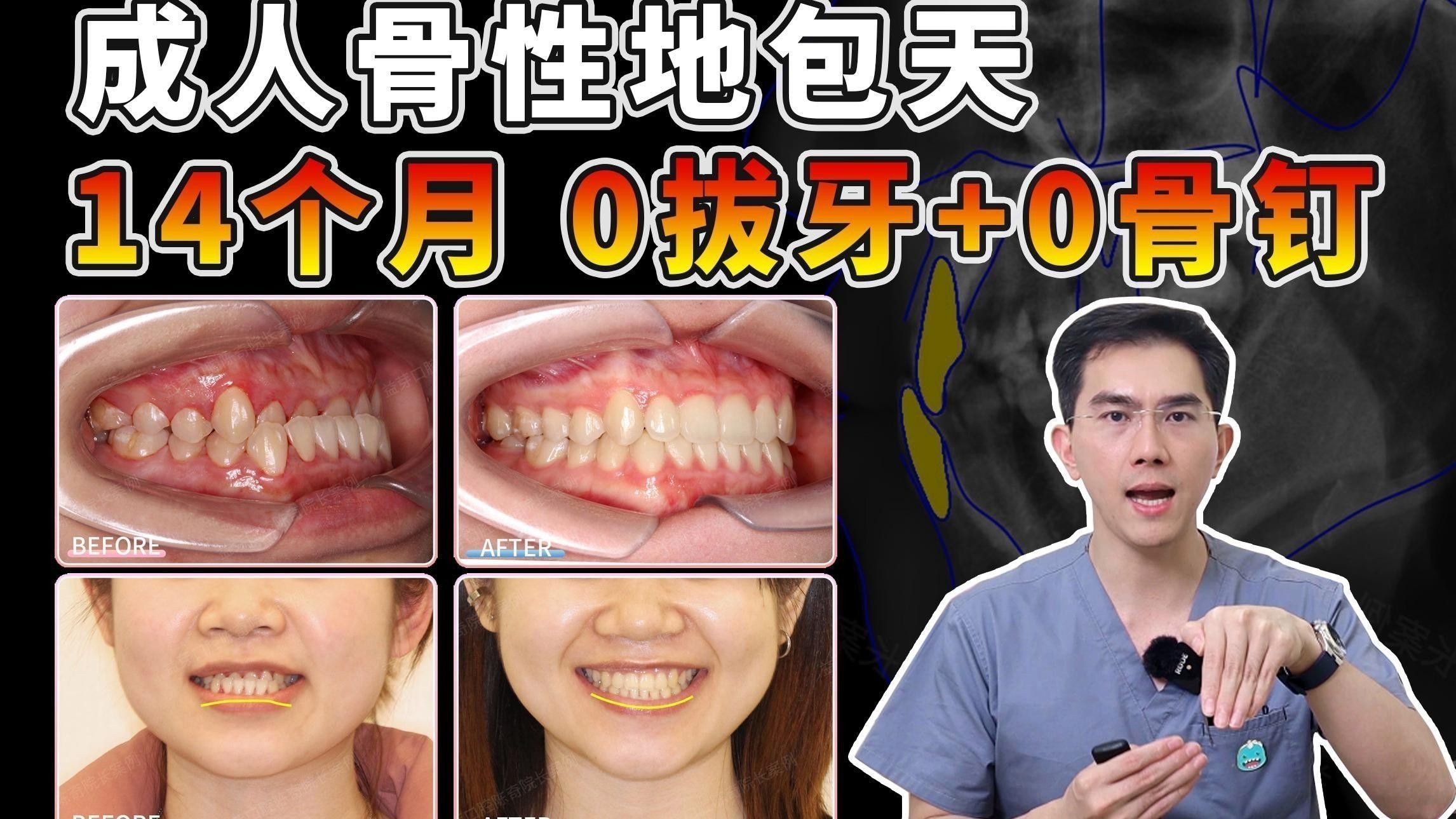 紅龍魚地包天手術的成功率有多高？
