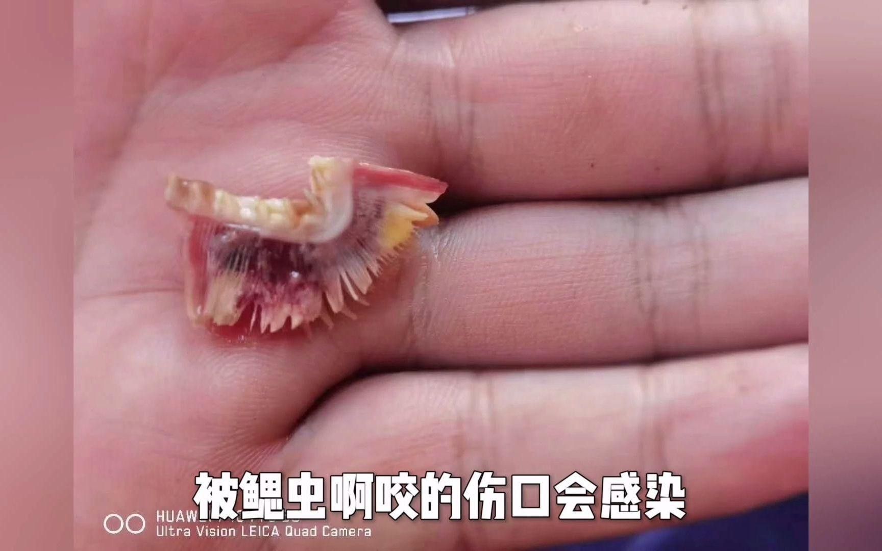 如何處理已經感染外寄生蟲的龍魚？
