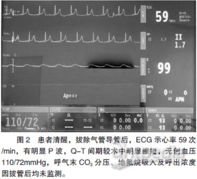 MS-222麻醉效果對比研究，ms-222與其他麻醉劑對比研究