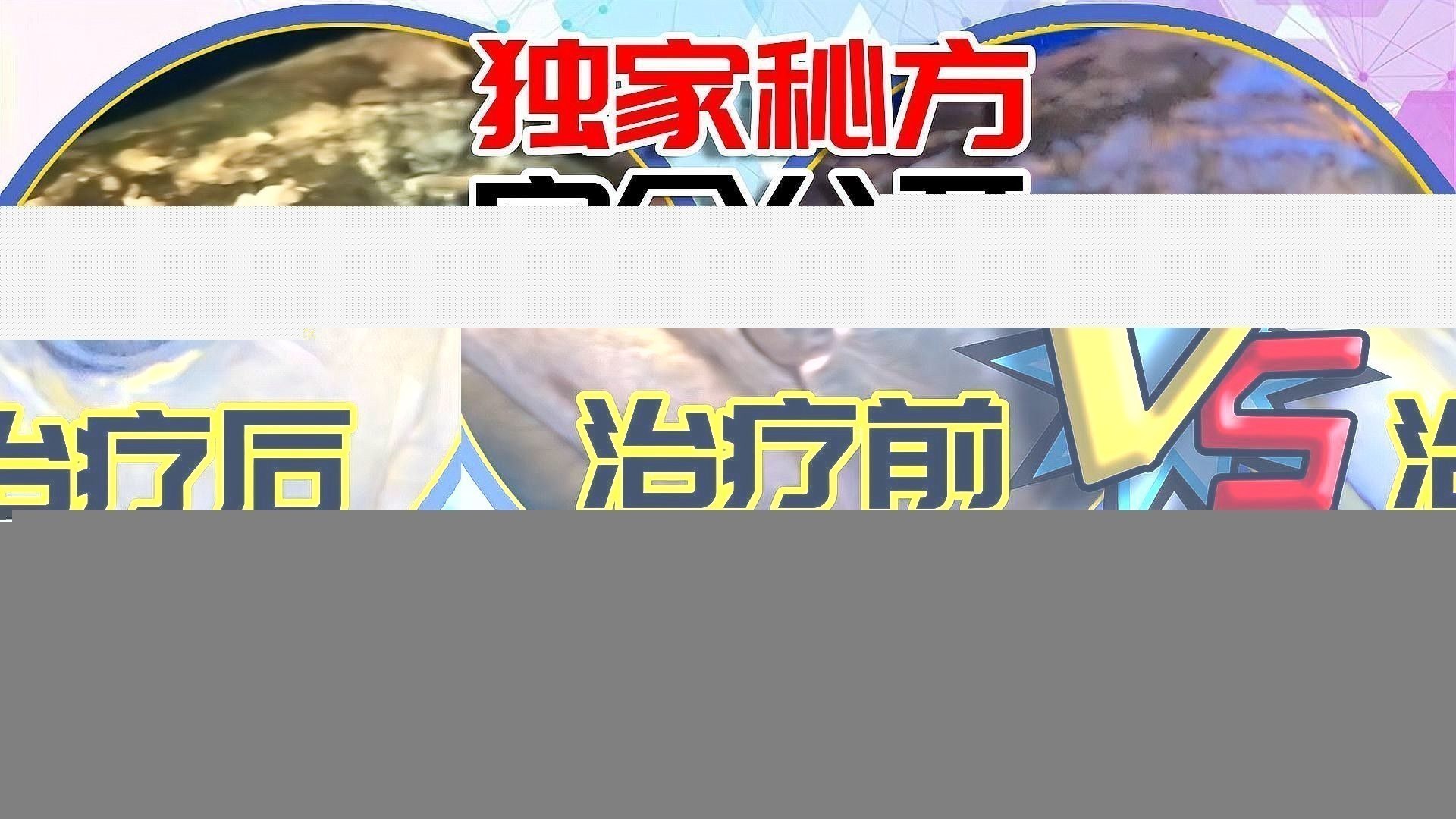 龍魚蒙眼嚴重怎么辦啊