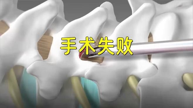 銀龍魚掉眼手術