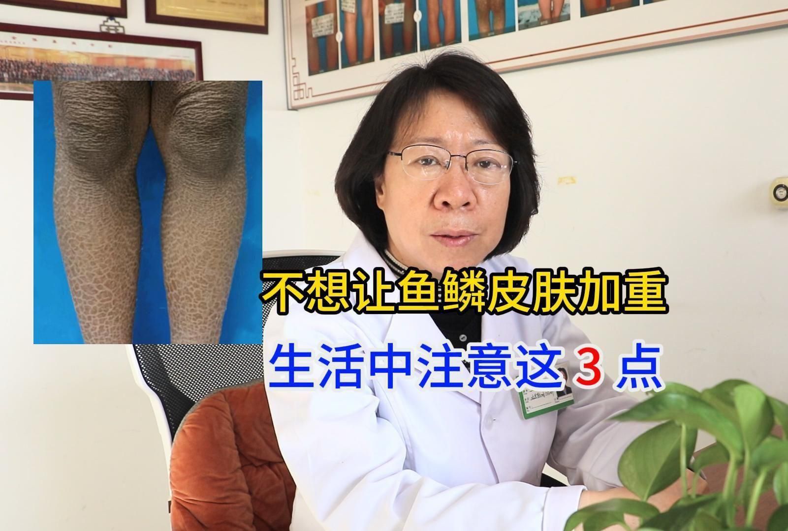 如何預防魚鱗皮膚病的加重？