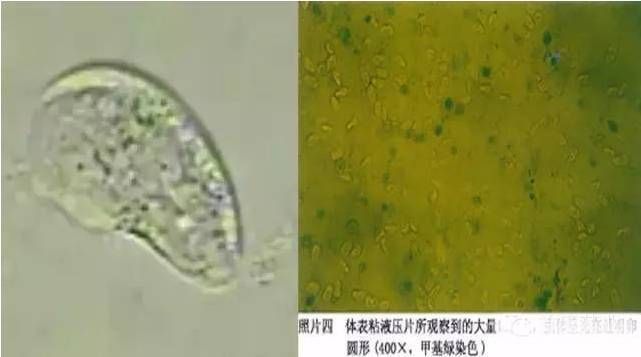 紅龍魚內寄有什么癥狀（如何預防紅龍魚內寄生蟲）