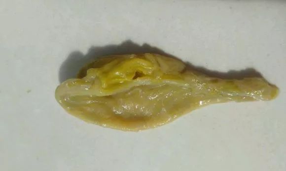 龍魚吐絮狀物（龍魚吐絮狀物可能由多種原因引起，）