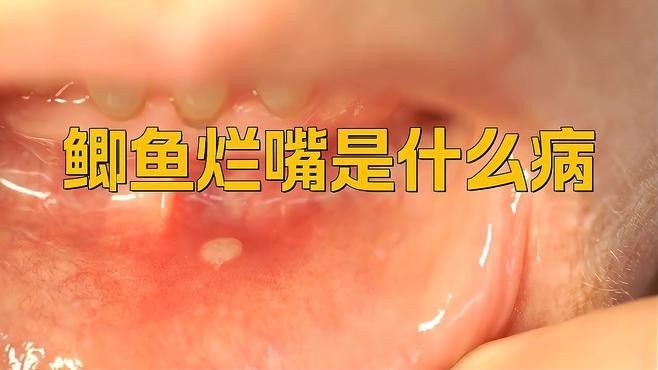 銀龍魚身上有紅點怎么辦