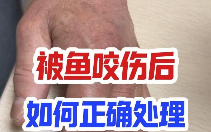 被金龍魚咬