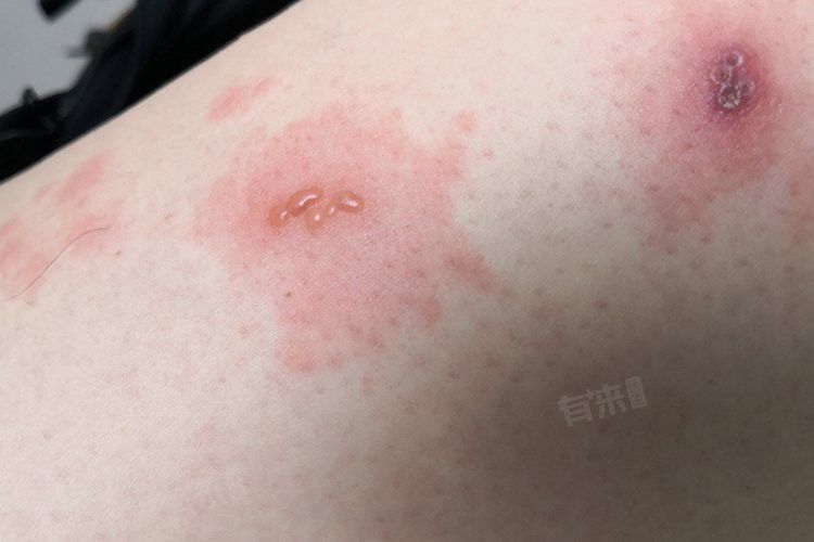 龍魚鰭感染會自愈嗎？
