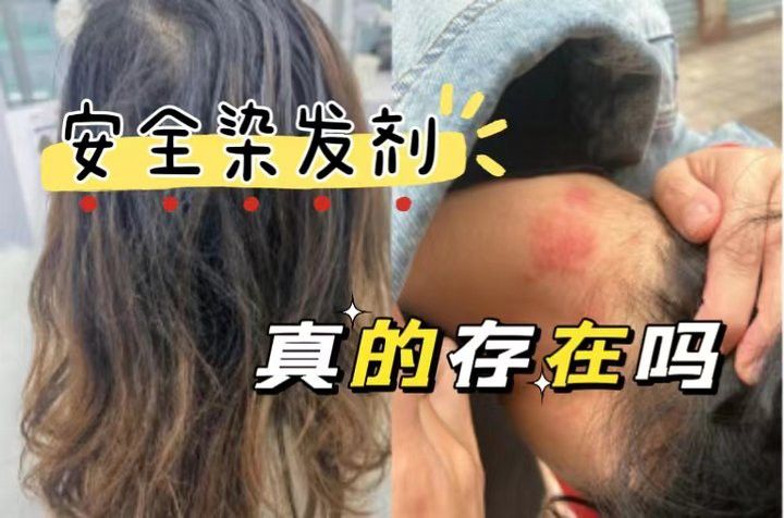 紅龍染發劑有哪些副作用？