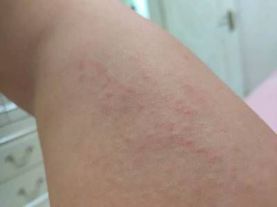 龍魚身上長白疙瘩怎么辦：龍魚身上出現白疙瘩可能是由多種原因引起的，如何預防