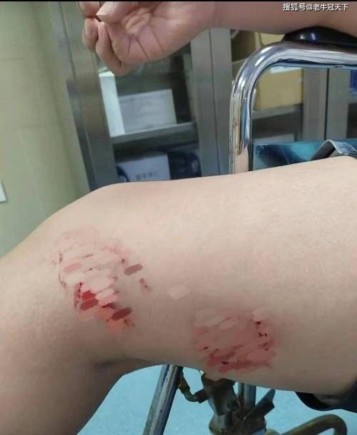 魚缸水綠了怎么解決，魚缸水質維護的日常技巧魚缸清道夫品種及飼養(yǎng)指南