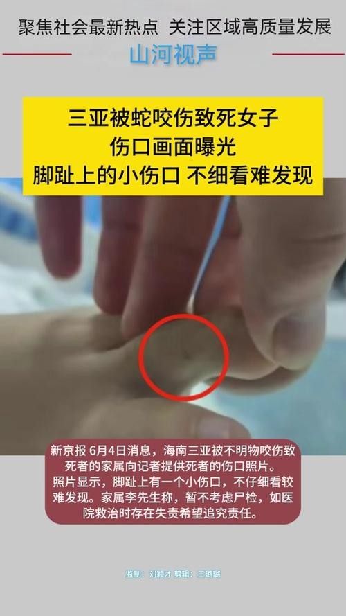 魚缸水綠了怎么解決，魚缸水質維護的日常技巧魚缸清道夫品種及飼養(yǎng)指南