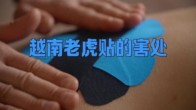 老虎膏有灼痛感要警惕了