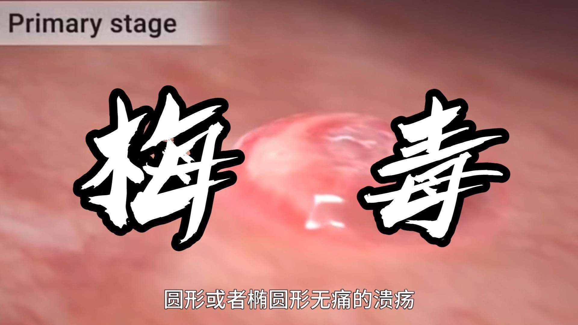 治療期間需要多久觀察一次？