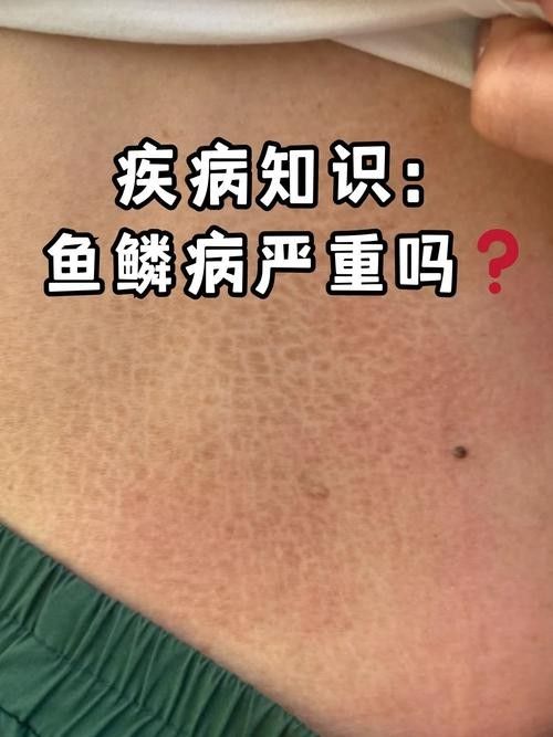 龍魚疾病圖解大全