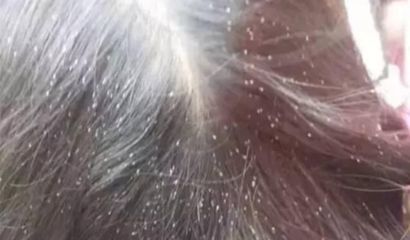 龍魚身上有小白點是什么蟲卵：龍魚白點病治療期間的注意事項龍魚白點病治療期間的注意事項