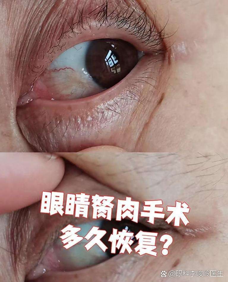 龍魚眼睛凸起手術(shù)后多久會恢復(fù)？