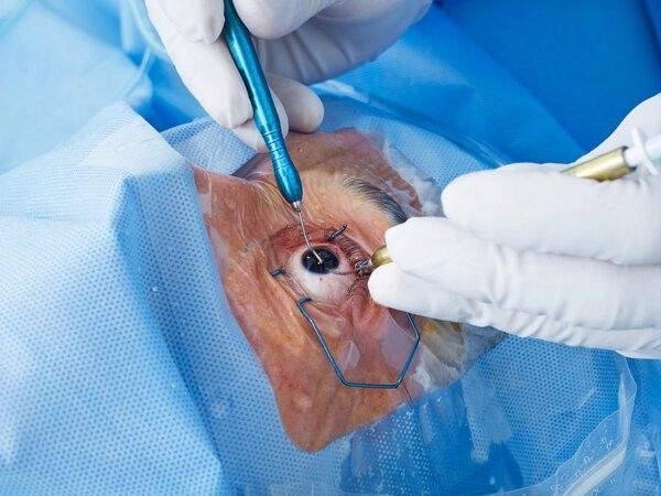 龍魚眼睛凸起手術(shù)后多久會恢復(fù)？