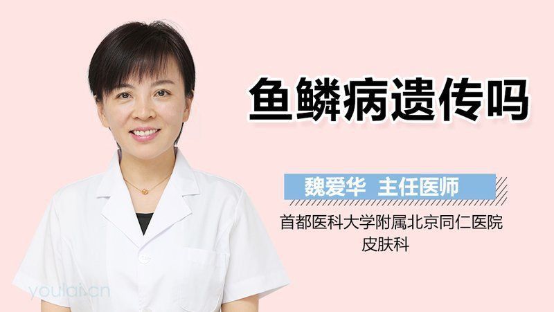 魚鱗病能否遺傳給下一代？