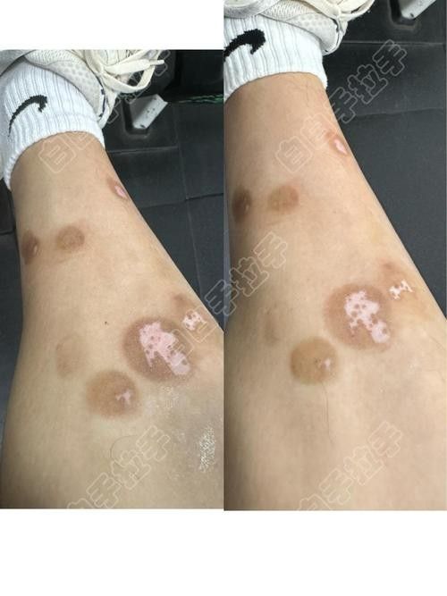 銀龍魚鼻子爛圖片真實