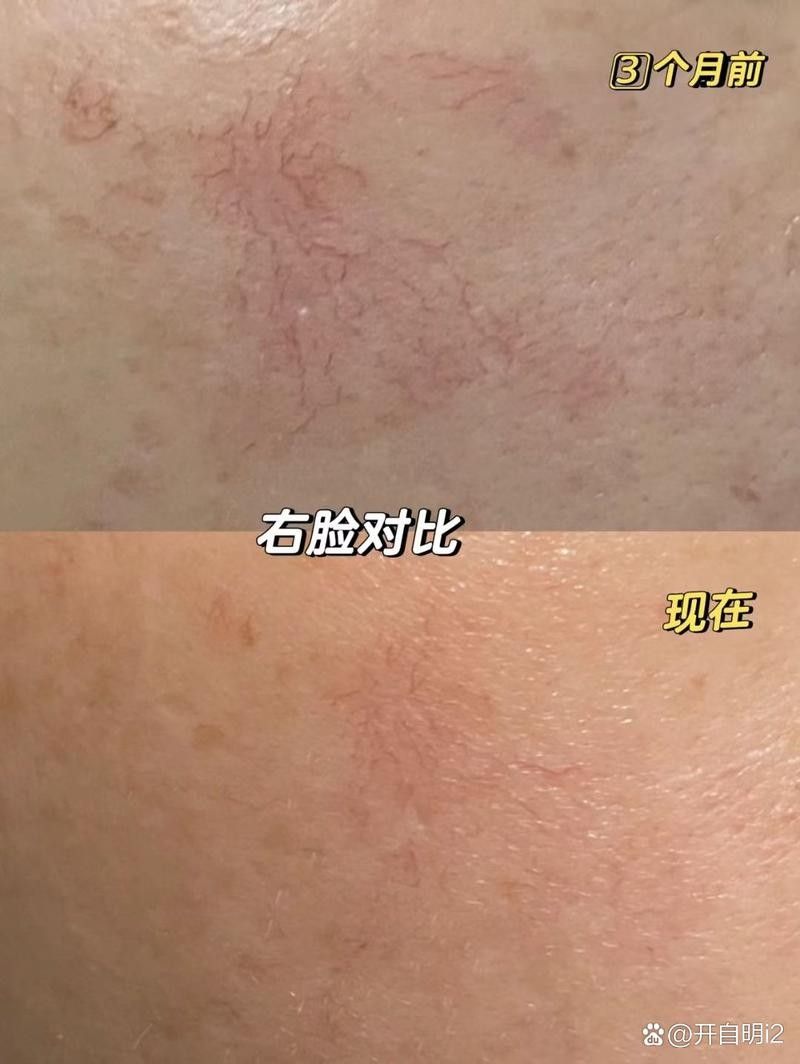 銀龍魚鼻子爛圖片真實