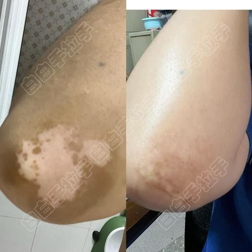 銀龍魚鼻子爛圖片真實