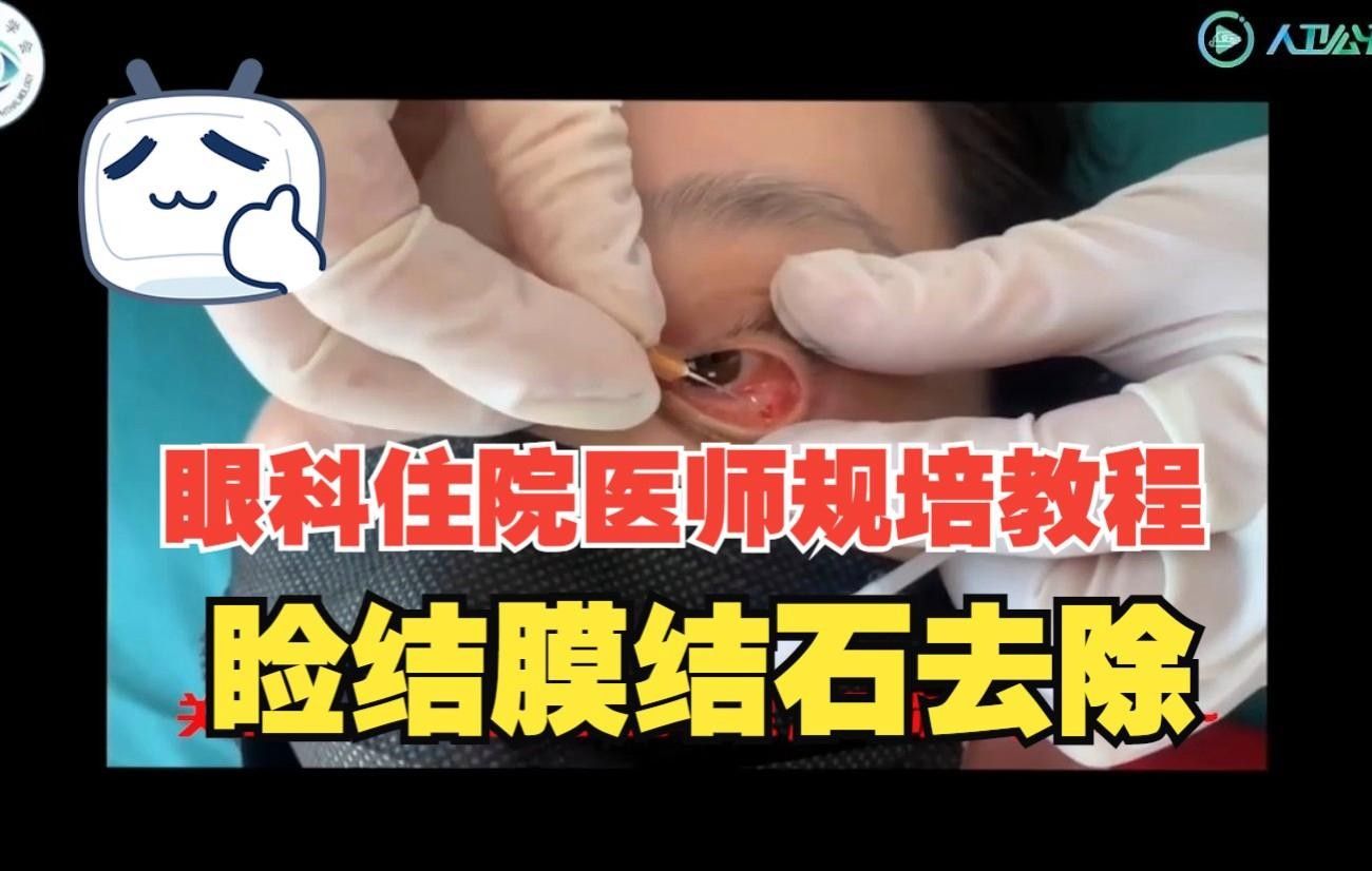 龍眼眼小白點如何自我診斷？