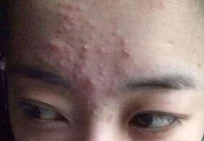 龍魚下巴長疙瘩咋回事（龍魚下巴長疙瘩是怎么回事？）