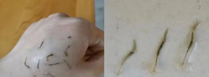魚身上有像蛆一樣的寄生蟲