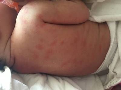 龍魚背部長疙瘩【龍魚背部長疙瘩可能由多種原因造成】