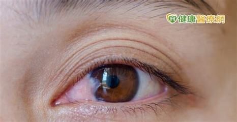 龍魚眼上有一小塊白膜怎么回事：龍魚眼上出現白膜可能是由多種原因引起的