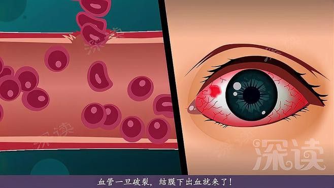 紅龍蒙眼病的癥狀有哪些？